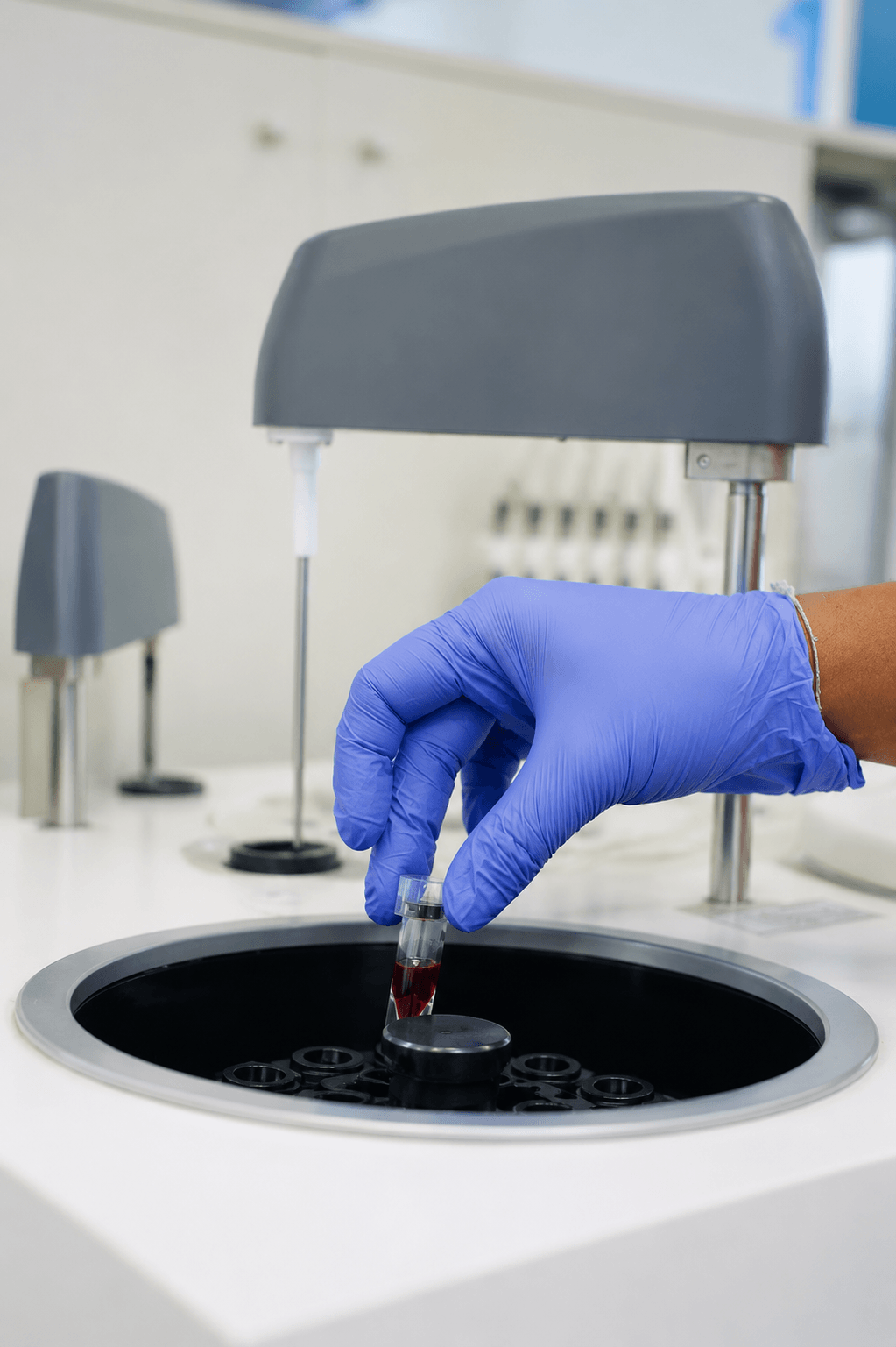 Modern laboratory technology at Lancet Diagnostics RT Nagar Bangalore